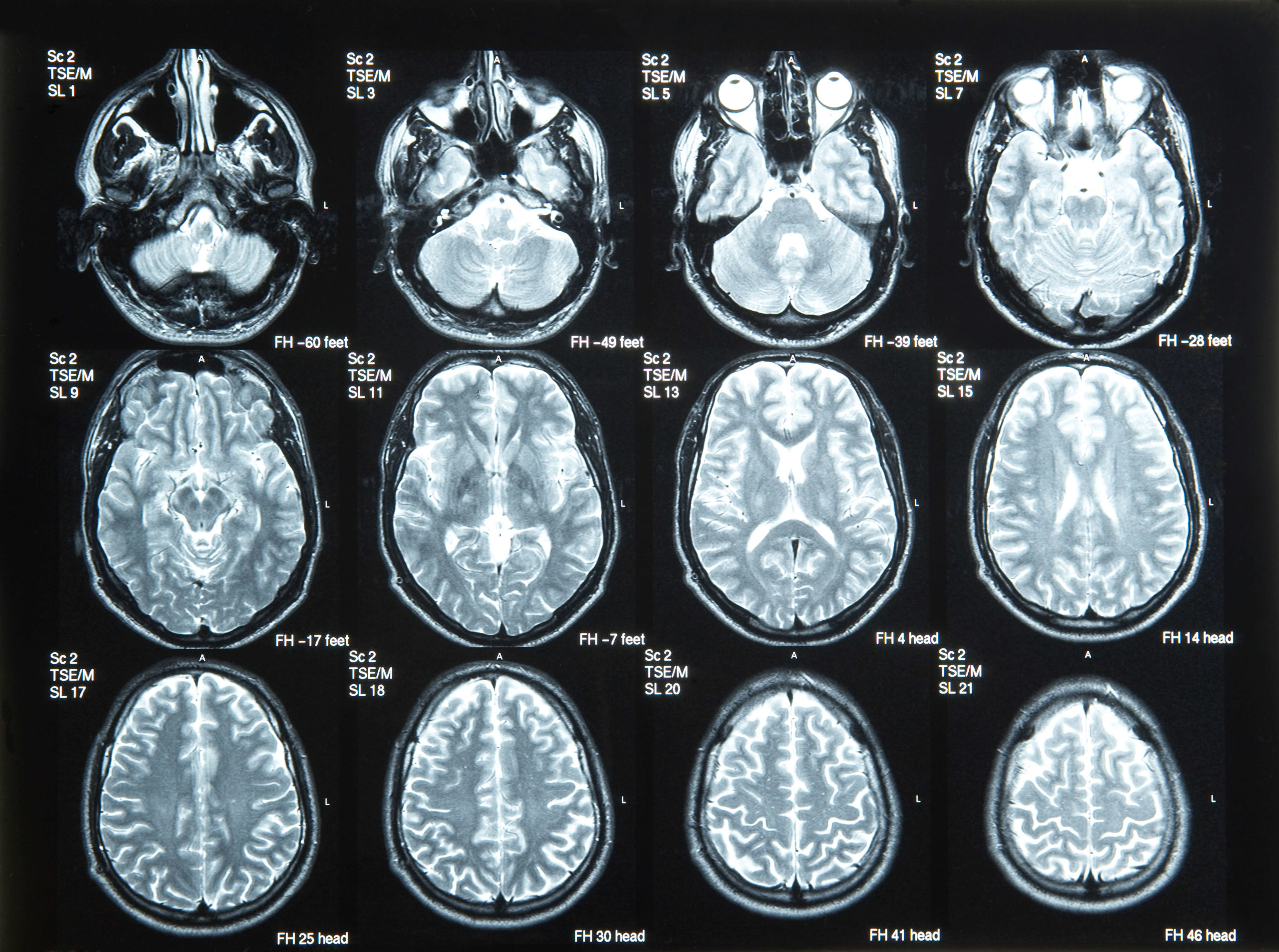 brain-x-rays
