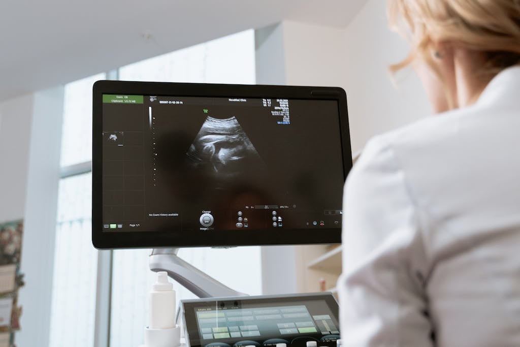 photo-of-an-ob-gyn-looking-in-the-monitor-7088485-1024x683