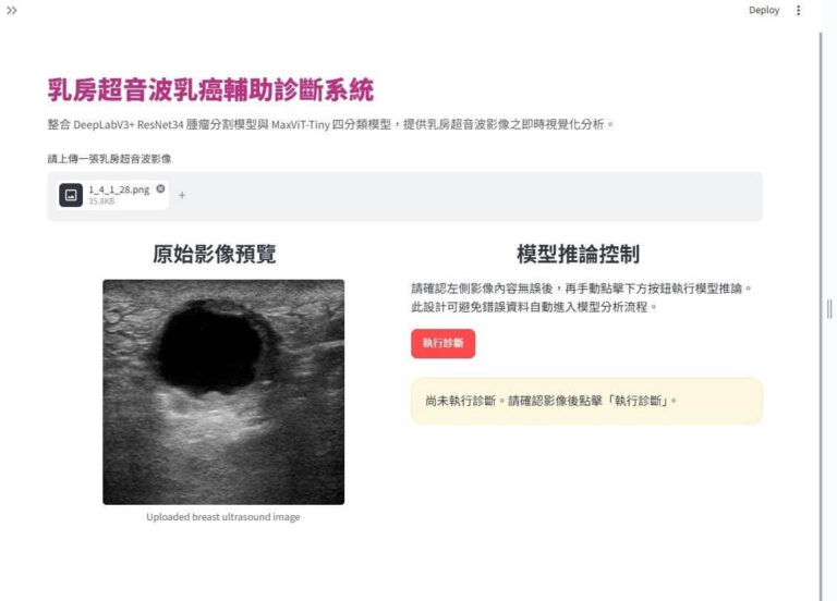 Breast Ultrasound Tumor Segmentation and Classification Using Deep Learning and Ensemble Learning