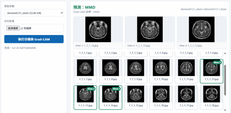 A Deep Learning and Attention Mechanism-Based Multiclass Computer-Aided Diagnosis Study for Moyamoya Disease, Arteriovenous Malformations, and Cerebral Aneurysms